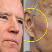 biden-clone-ear